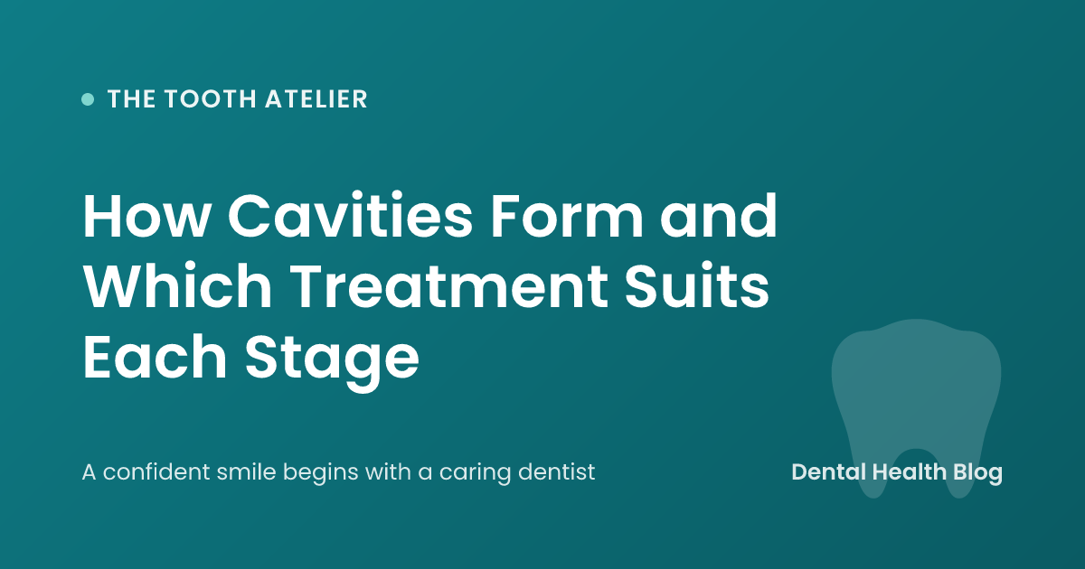 How Cavities Form and Which Treatment Suits Each Stage