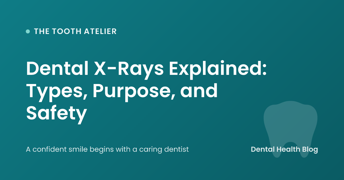 Dental X-Rays Explained: Types, Purpose, and Safety