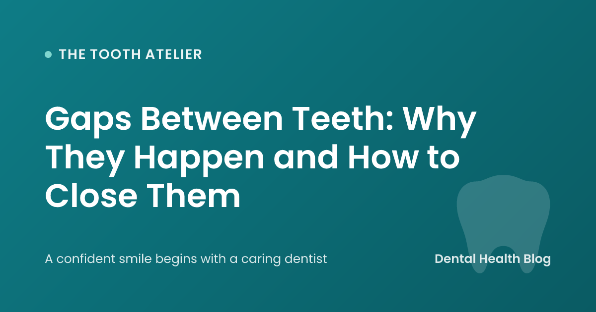 Gaps Between Teeth: Why They Happen and How to Close Them