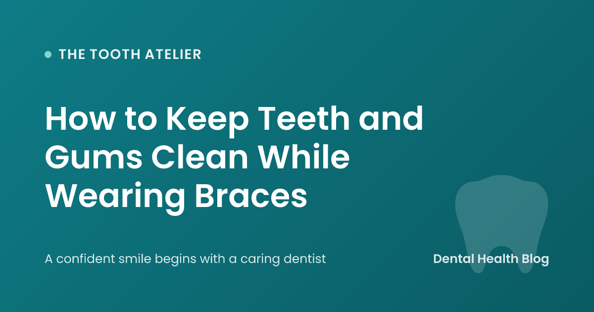How to Keep Teeth and Gums Clean While Wearing Braces